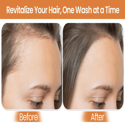 Biotin Shampoo & Conditioner